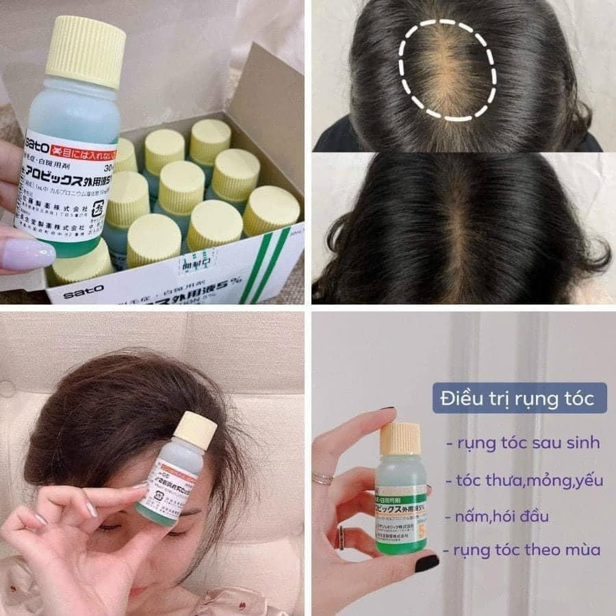 Thuốc mọc tóc thảo dược Sato Nhật Bản 30ml
