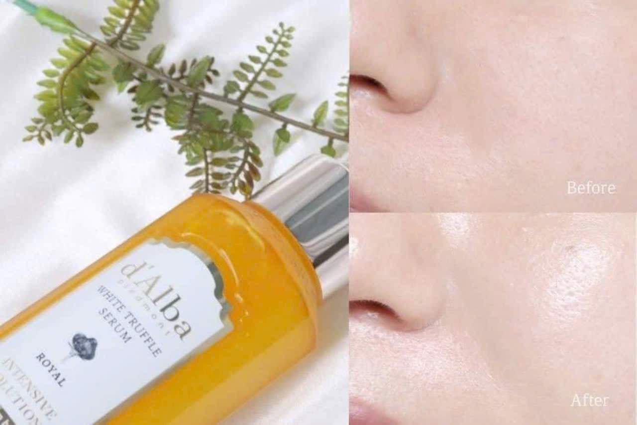 Tinh chất xịt khoáng D’Alba Roya làm trắng, chống nhăn 100ml