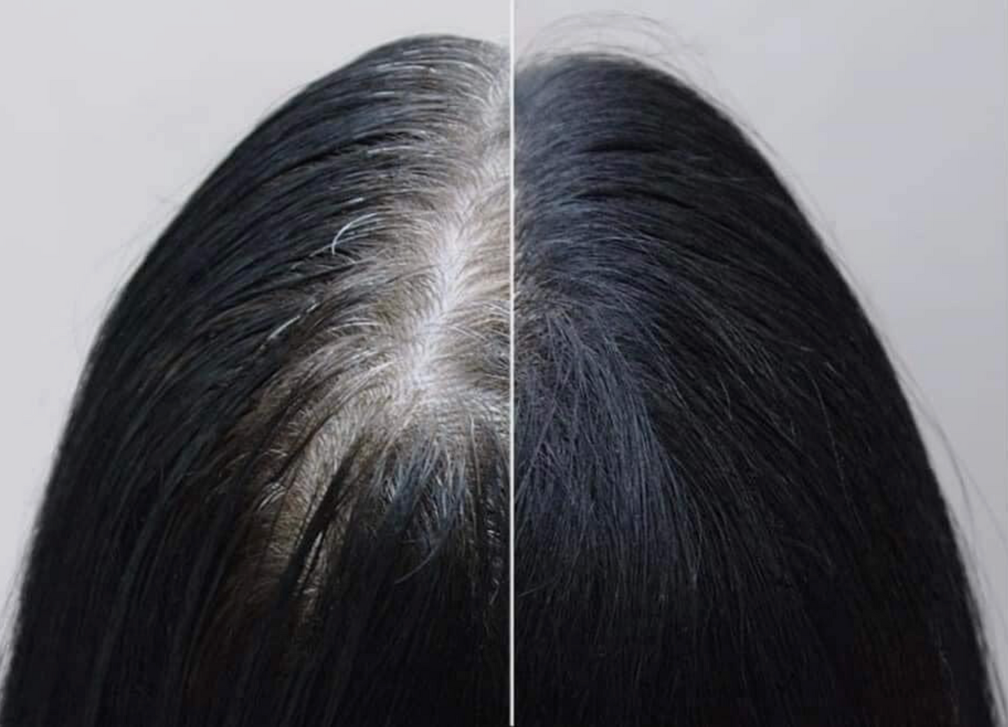 Viên Uống Hà Thủ Ô Hàn Quốc Set 3 Chai